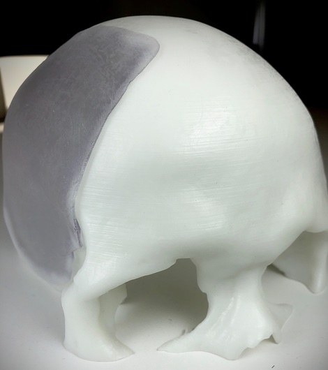 3D model of skull created using stereolithography process